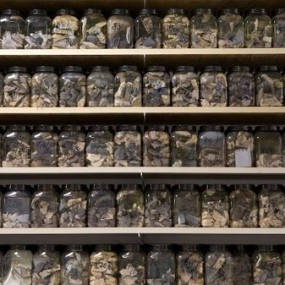 人在太平间里的最后时光